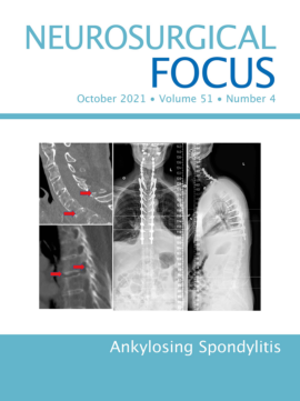 Magazine cover reading Neurosurgical Focus, October 2021, Volume 51, Number 4, Ankylosing Spondylitis